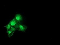 CAT Antibody in Immunocytochemistry (ICC/IF)