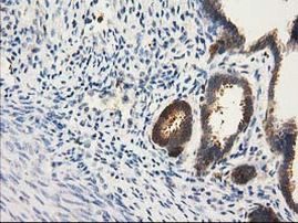 CAT Antibody in Immunohistochemistry (Paraffin) (IHC (P))