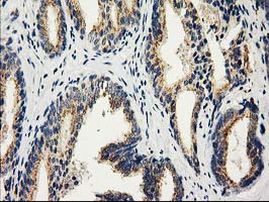 CAT Antibody in Immunohistochemistry (Paraffin) (IHC (P))