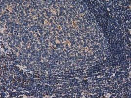 CAT Antibody in Immunohistochemistry (Paraffin) (IHC (P))