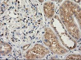 CAT Antibody in Immunohistochemistry (Paraffin) (IHC (P))