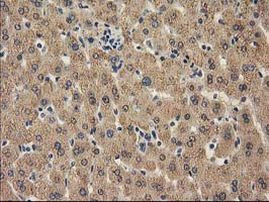 CAT Antibody in Immunohistochemistry (Paraffin) (IHC (P))