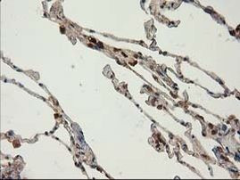 CAT Antibody in Immunohistochemistry (Paraffin) (IHC (P))