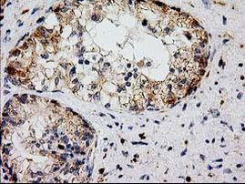 CAT Antibody in Immunohistochemistry (Paraffin) (IHC (P))