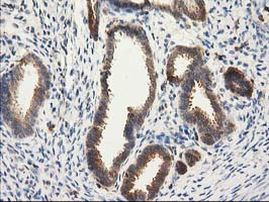 CAT Antibody in Immunohistochemistry (Paraffin) (IHC (P))