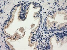 CAT Antibody in Immunohistochemistry (Paraffin) (IHC (P))