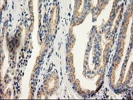 CAT Antibody in Immunohistochemistry (Paraffin) (IHC (P))