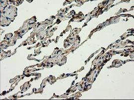 CAT Antibody in Immunohistochemistry (Paraffin) (IHC (P))