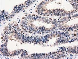 CAT Antibody in Immunohistochemistry (Paraffin) (IHC (P))