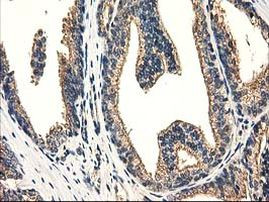 CAT Antibody in Immunohistochemistry (Paraffin) (IHC (P))