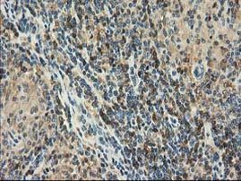 CAT Antibody in Immunohistochemistry (Paraffin) (IHC (P))