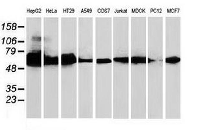 CAT Antibody in Western Blot (WB)