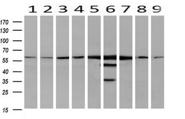 CAT Antibody in Western Blot (WB)