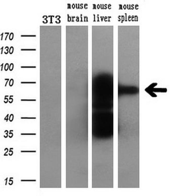 CAT Antibody in Western Blot (WB)