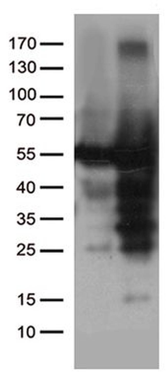 CAT Antibody in Western Blot (WB)