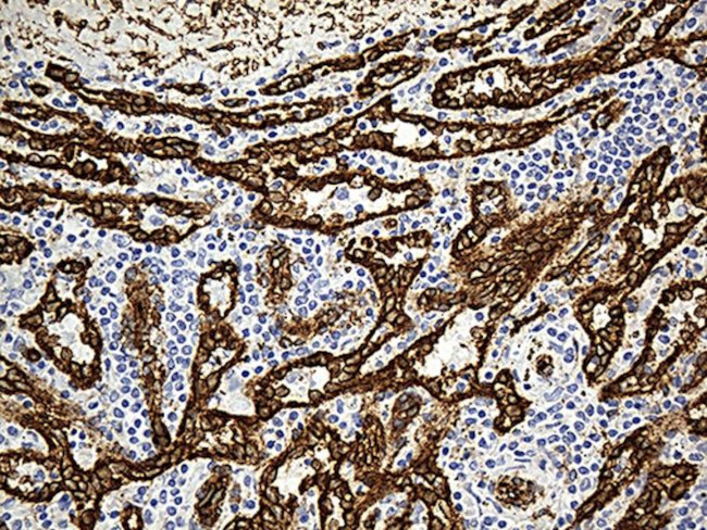 CAV1 Antibody in Immunohistochemistry (Paraffin) (IHC (P))