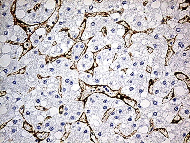 CAV1 Antibody in Immunohistochemistry (Paraffin) (IHC (P))