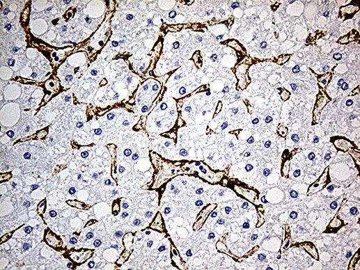 CAV1 Antibody in Immunohistochemistry (Paraffin) (IHC (P))