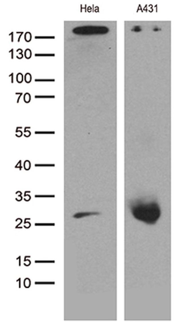 CAV1 Antibody in Western Blot (WB)