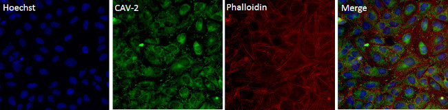 Phospho-Caveolin 2 (Tyr19) Antibody in Immunocytochemistry (ICC/IF)