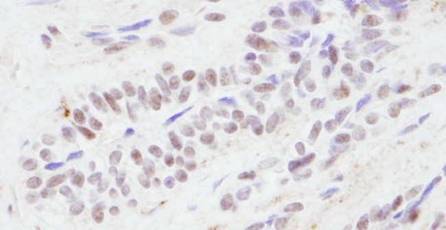 CBP Antibody in Immunohistochemistry (IHC)