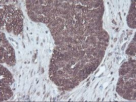 CBR3 Antibody in Immunohistochemistry (Paraffin) (IHC (P))