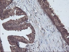 CBR3 Antibody in Immunohistochemistry (Paraffin) (IHC (P))