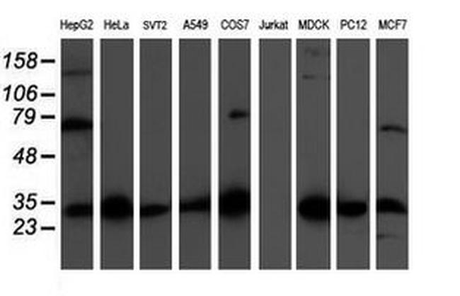 CBR3 Antibody in Western Blot (WB)