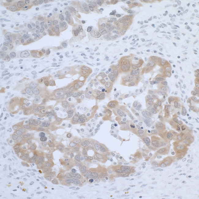 CBS Antibody in Immunohistochemistry (IHC)