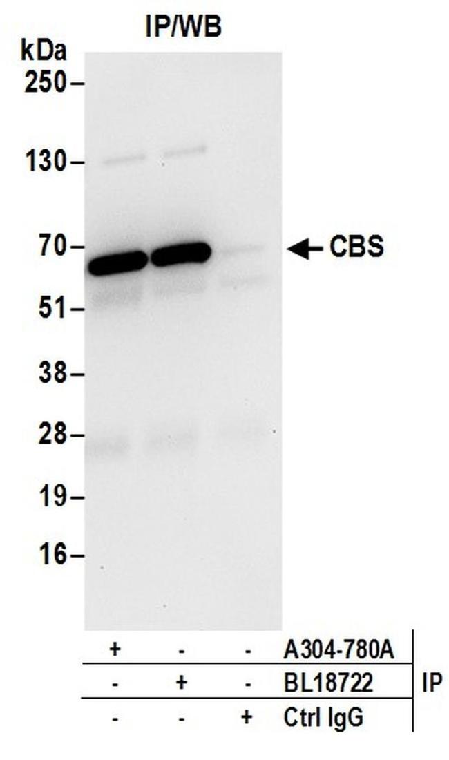 CBS Antibody in Western Blot (WB)