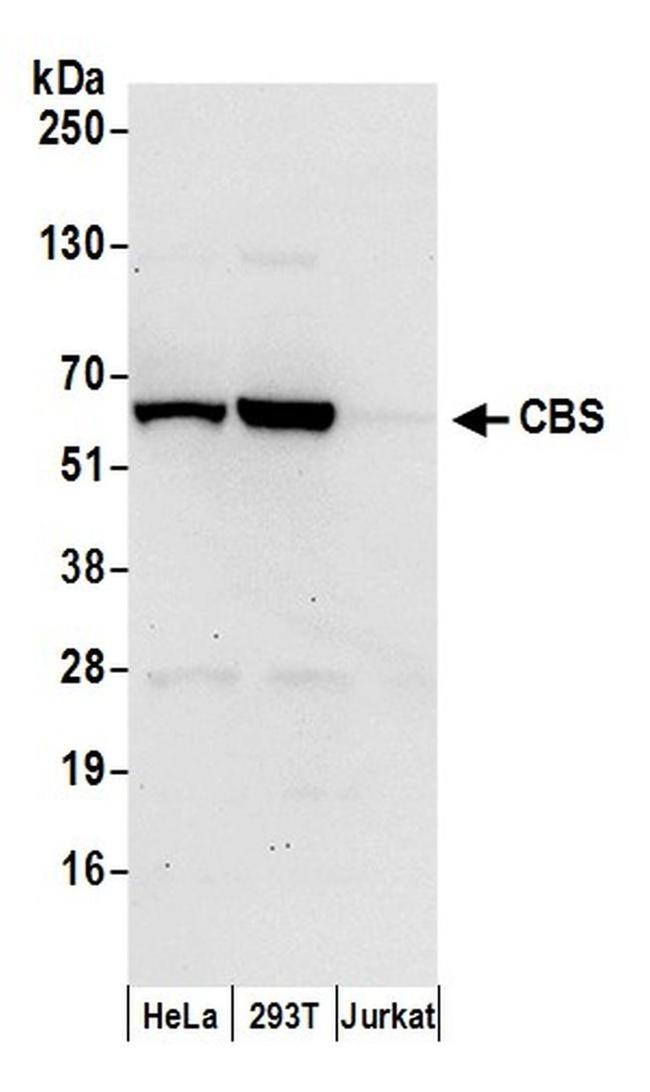 CBS Antibody in Western Blot (WB)