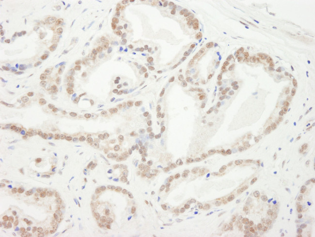 CBX5 Antibody in Immunohistochemistry (IHC)