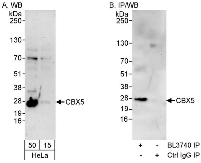 CBX5 Antibody in Western Blot (WB)