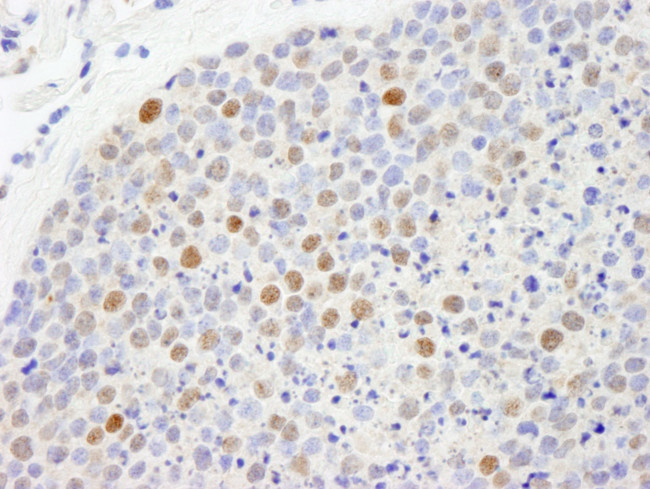 CBX5 Antibody in Immunohistochemistry (IHC)