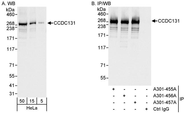 CCDC131 Antibody in Western Blot (WB)