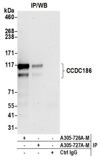 CCDC186 Antibody in Immunoprecipitation (IP)