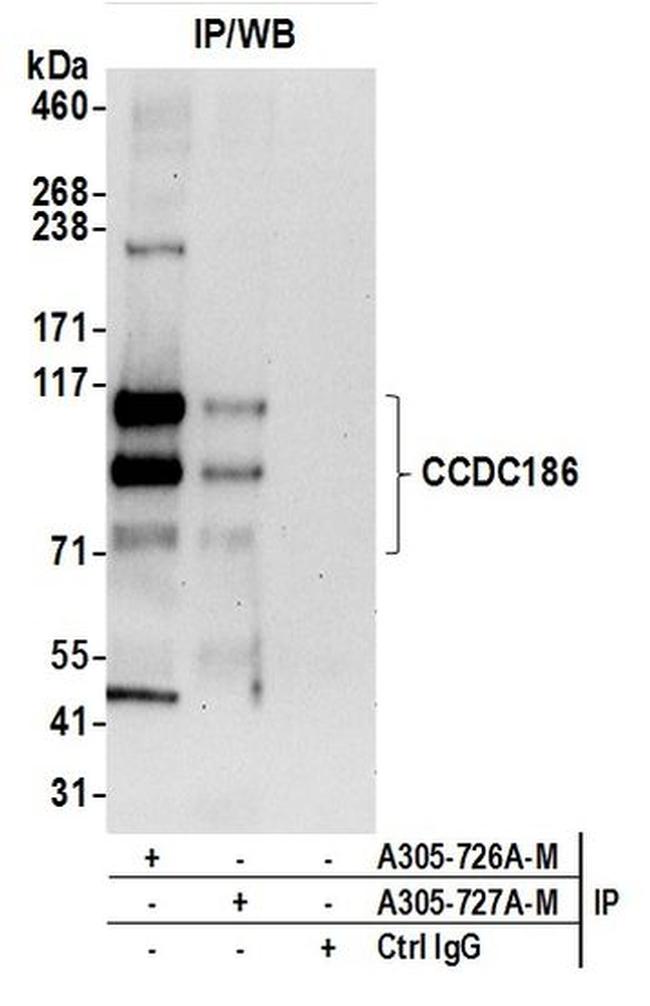 CCDC186 Antibody in Western Blot (WB)