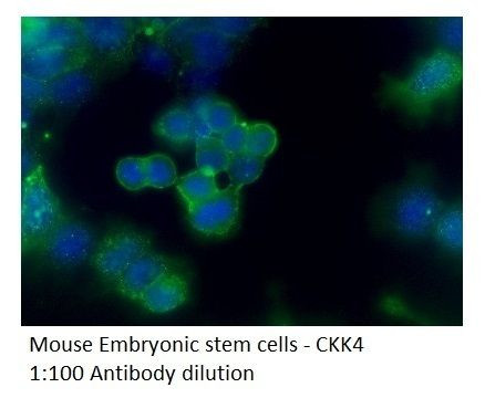 CCK4 Antibody in Immunohistochemistry (IHC)