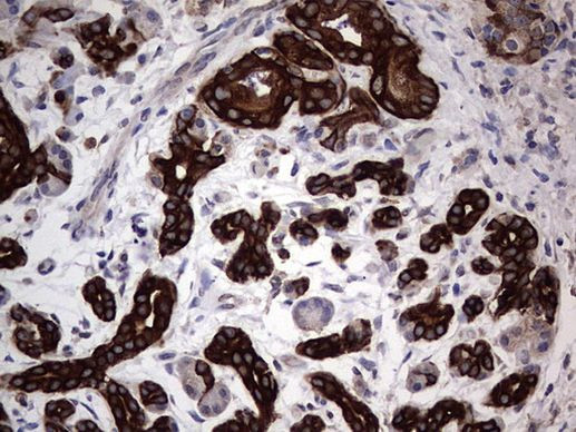 CCL19 Antibody in Immunohistochemistry (Paraffin) (IHC (P))