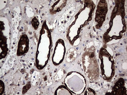 CCL19 Antibody in Immunohistochemistry (Paraffin) (IHC (P))