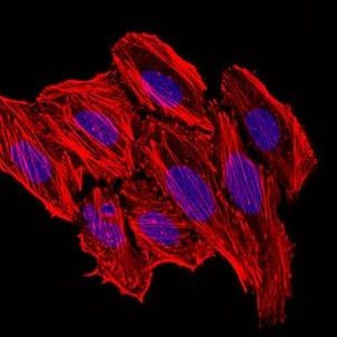 MCP-1 Antibody in Immunocytochemistry (ICC/IF)