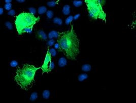 CCM2 Antibody in Immunocytochemistry (ICC/IF)