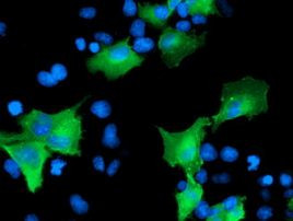 CCM2 Antibody in Immunocytochemistry (ICC/IF)