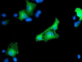 CCM2 Antibody in Immunocytochemistry (ICC/IF)