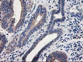 CCM2 Antibody in Immunohistochemistry (Paraffin) (IHC (P))