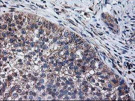 CCM2 Antibody in Immunohistochemistry (Paraffin) (IHC (P))