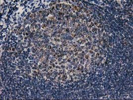 CCM2 Antibody in Immunohistochemistry (Paraffin) (IHC (P))