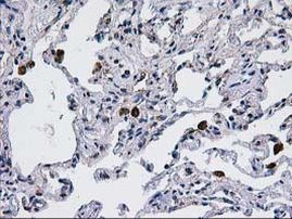 CCM2 Antibody in Immunohistochemistry (Paraffin) (IHC (P))