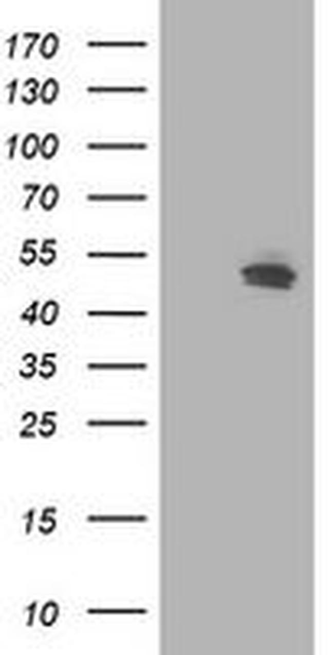 CCM2 Antibody in Western Blot (WB)