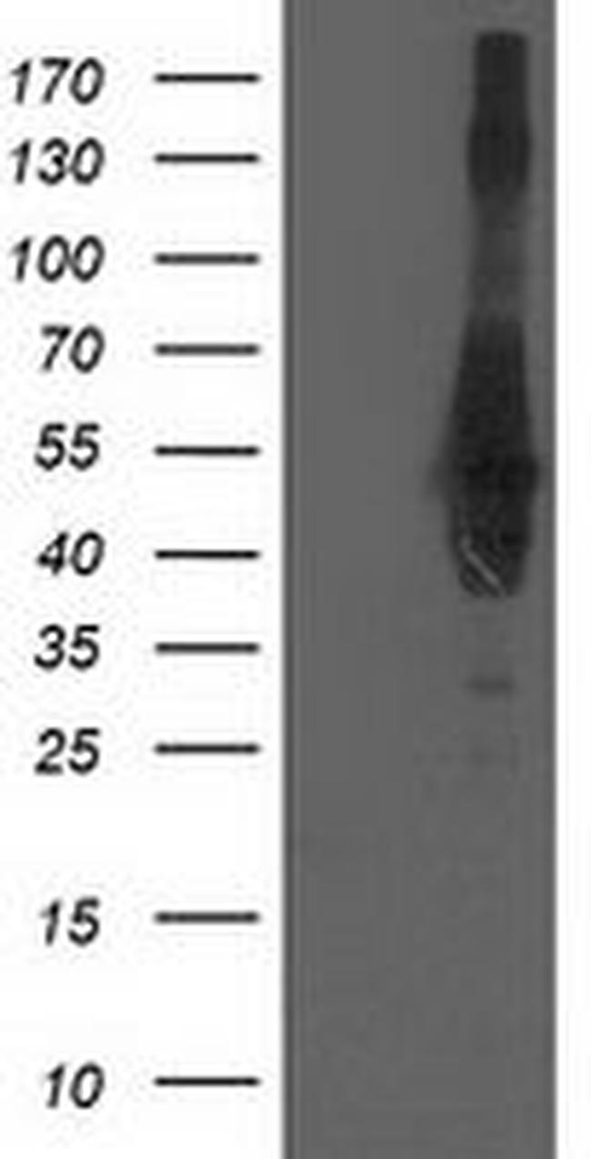 CCM2 Antibody in Western Blot (WB)